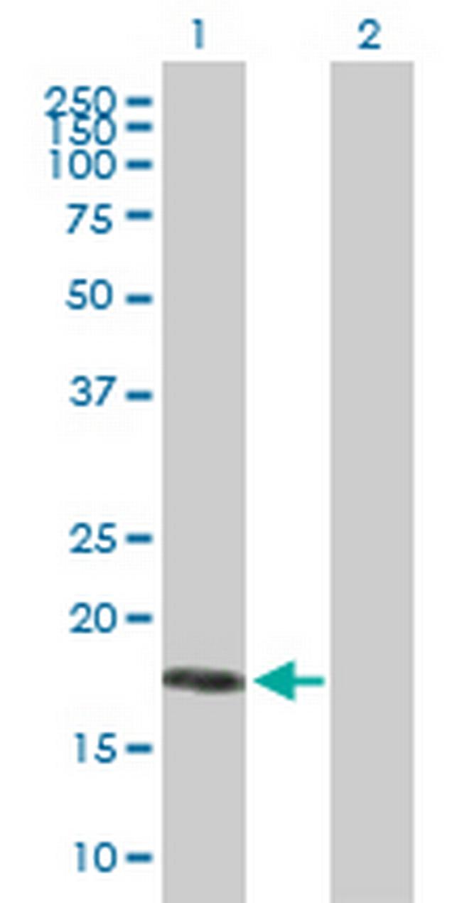 MRAP Antibody in Western Blot (WB)