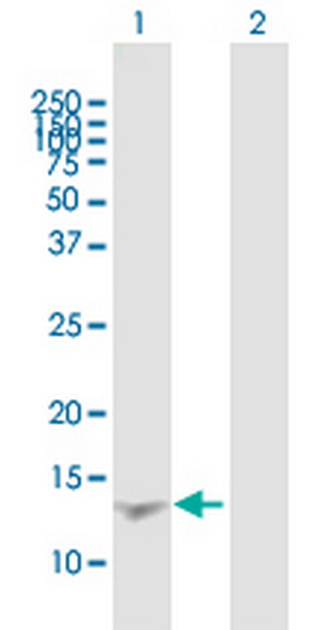 RETN Antibody in Western Blot (WB)