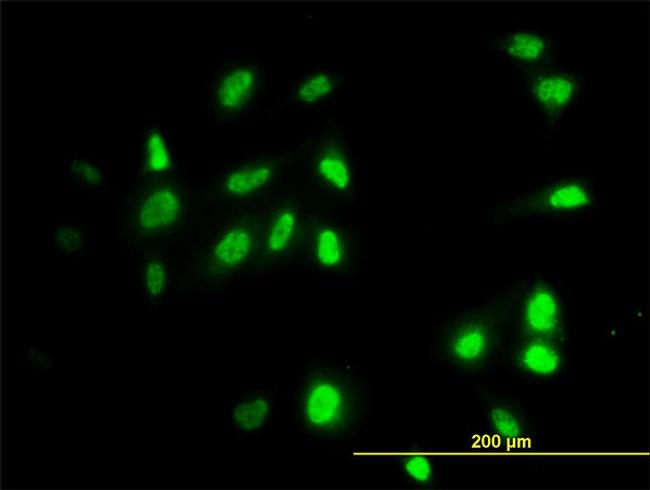 RAD18 Antibody in Immunocytochemistry (ICC/IF)