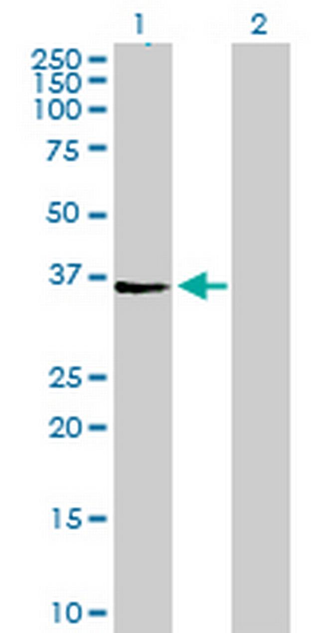 AGPAT4 Antibody in Western Blot (WB)