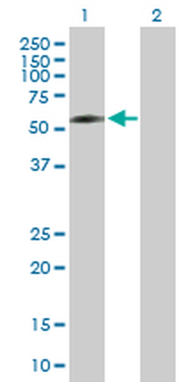 DPYSL5 Antibody in Western Blot (WB)