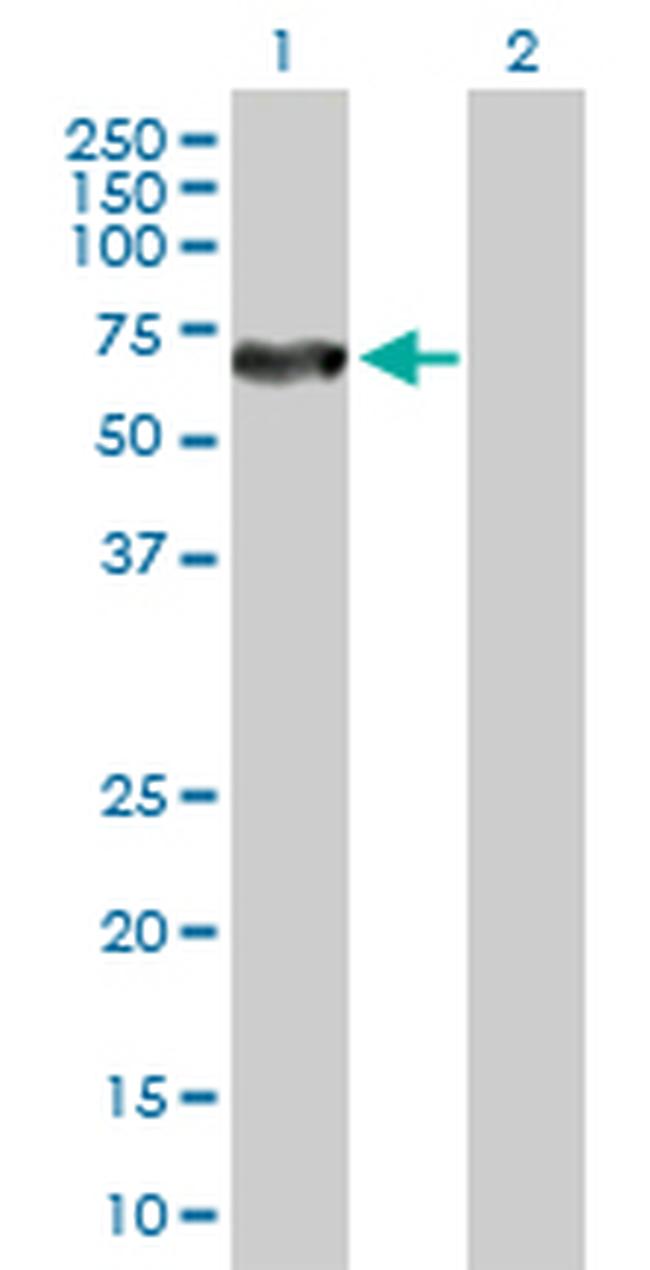 DPYSL5 Antibody in Western Blot (WB)