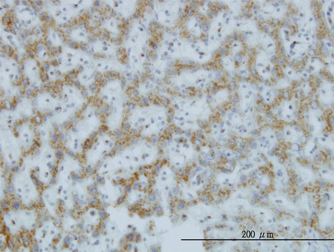 C1GALT1 Antibody in Immunohistochemistry (Paraffin) (IHC (P))