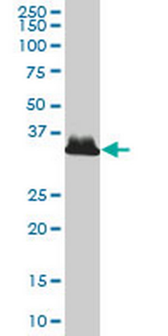 AKR1B10 Antibody in Western Blot (WB)