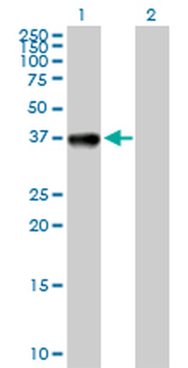 CIAPIN1 Antibody in Western Blot (WB)