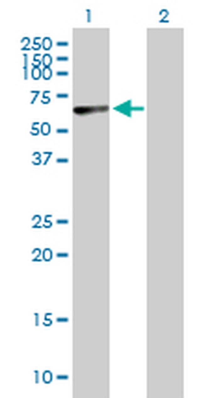 PNPLA2 Antibody in Western Blot (WB)