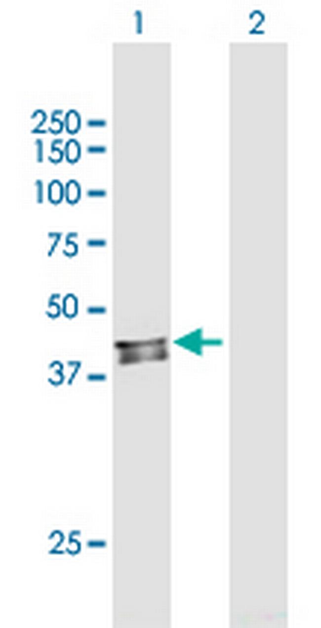 C6orf210 Antibody in Western Blot (WB)