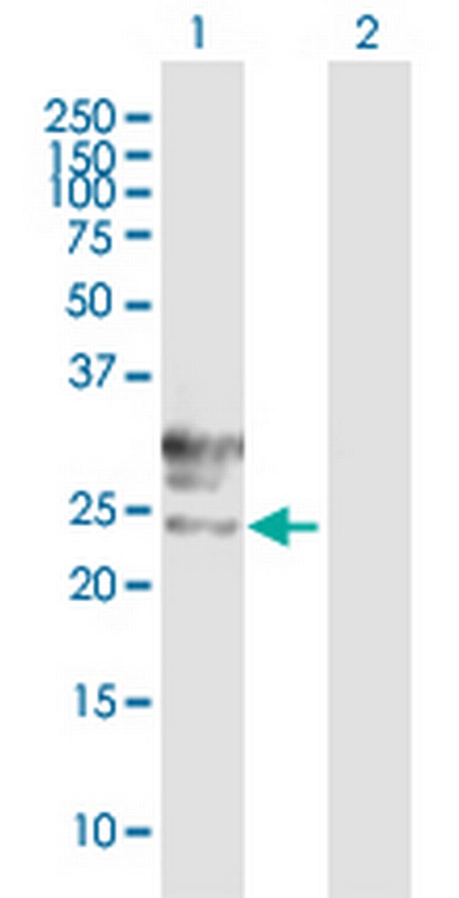 TMEM27 Antibody in Western Blot (WB)