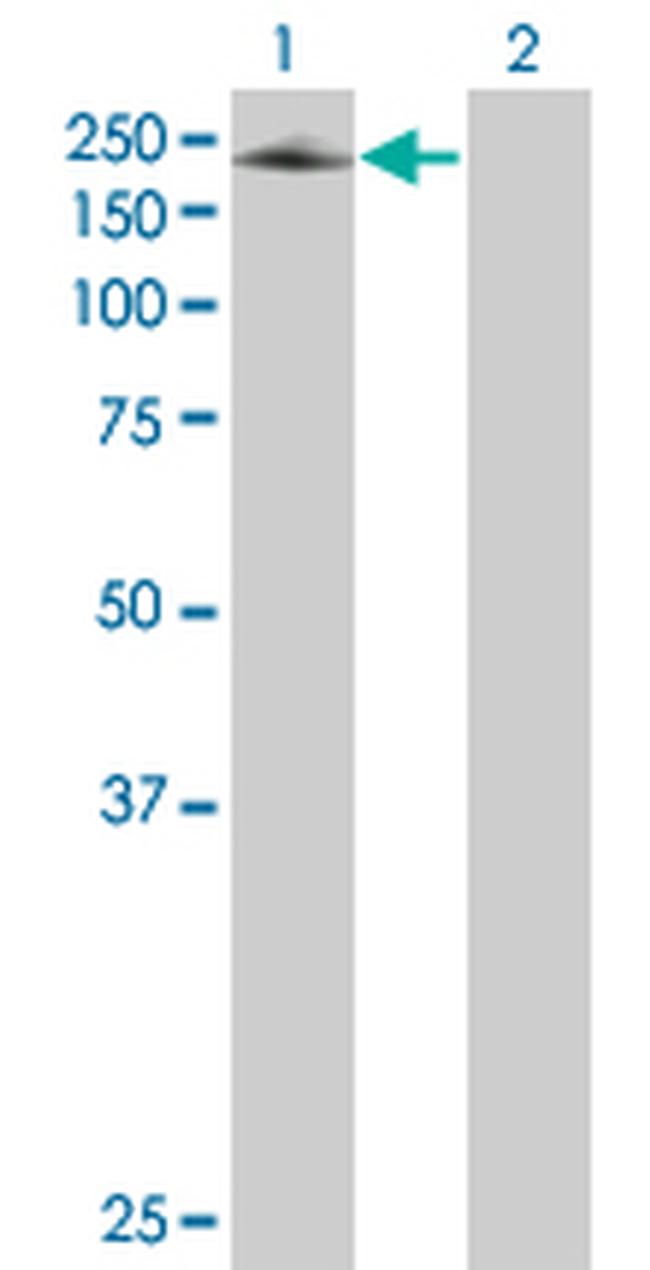 SEMA6A Antibody in Western Blot (WB)