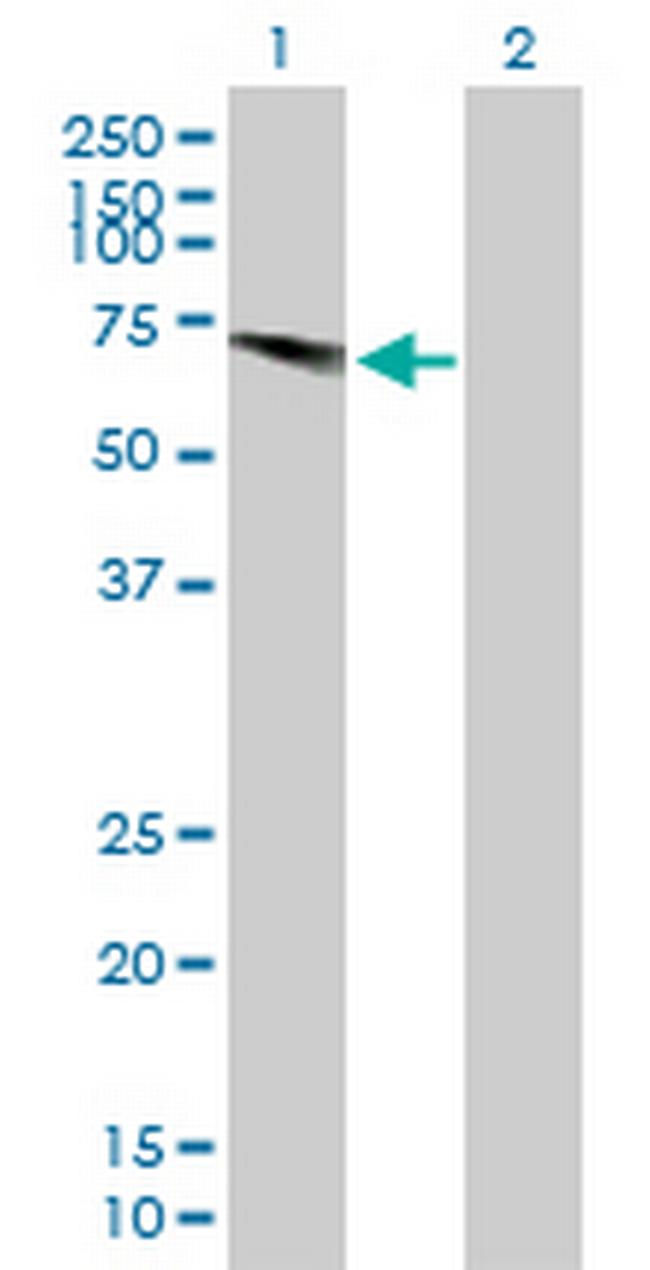 USP28 Antibody in Western Blot (WB)