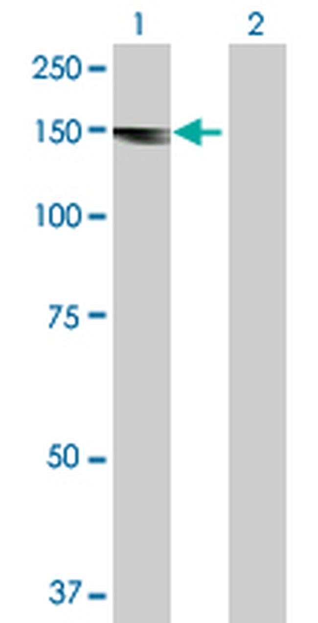 ALS2 Antibody in Western Blot (WB)