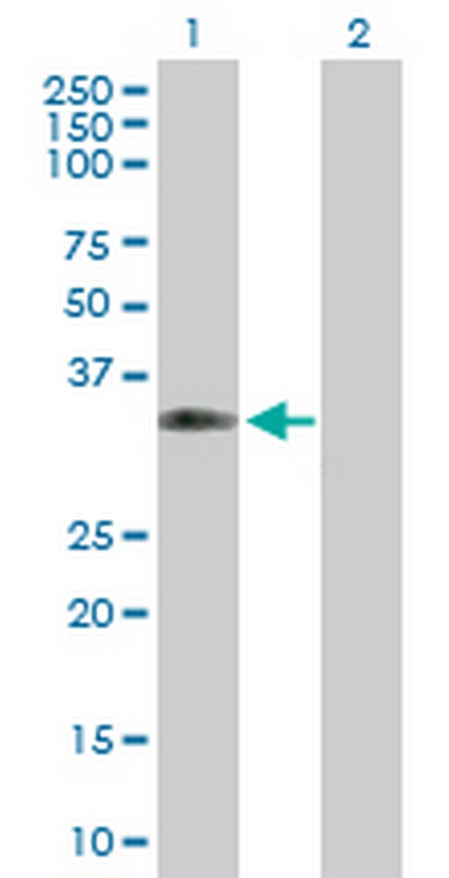 CPNE5 Antibody in Western Blot (WB)