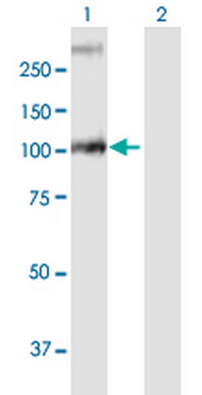 GBA2 Antibody in Western Blot (WB)