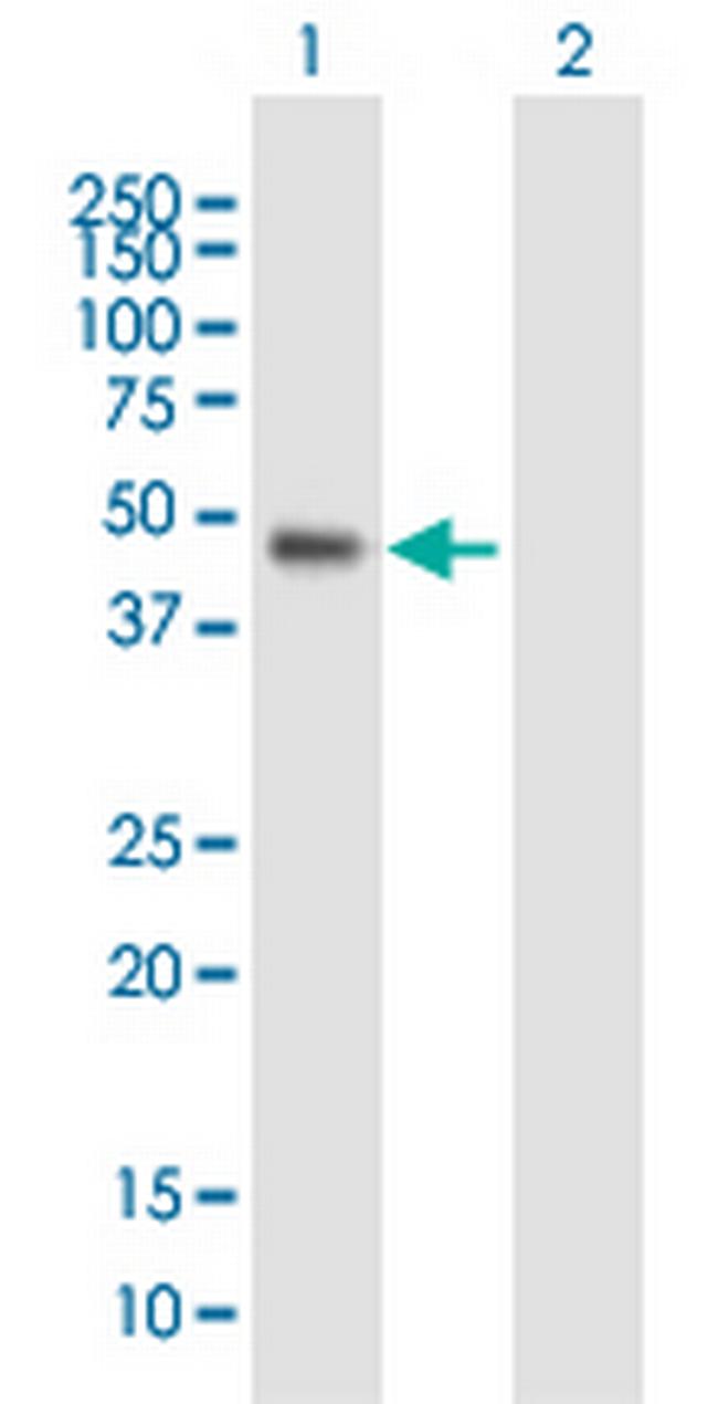 WDR19 Antibody in Western Blot (WB)