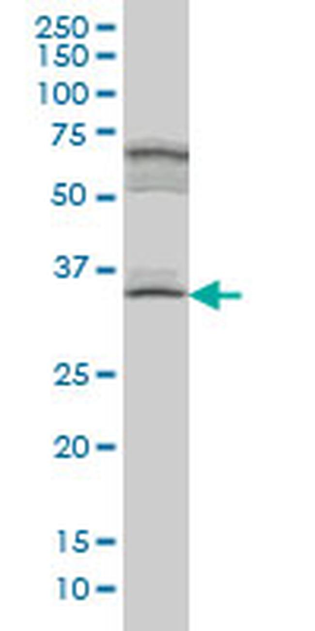 MYOZ1 Antibody in Western Blot (WB)