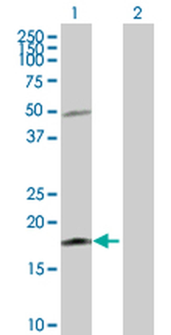 IL21 Antibody in Western Blot (WB)