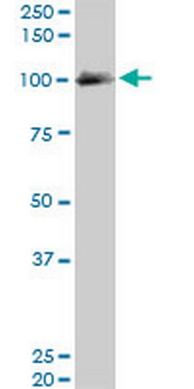 EXOC4 Antibody in Western Blot (WB)