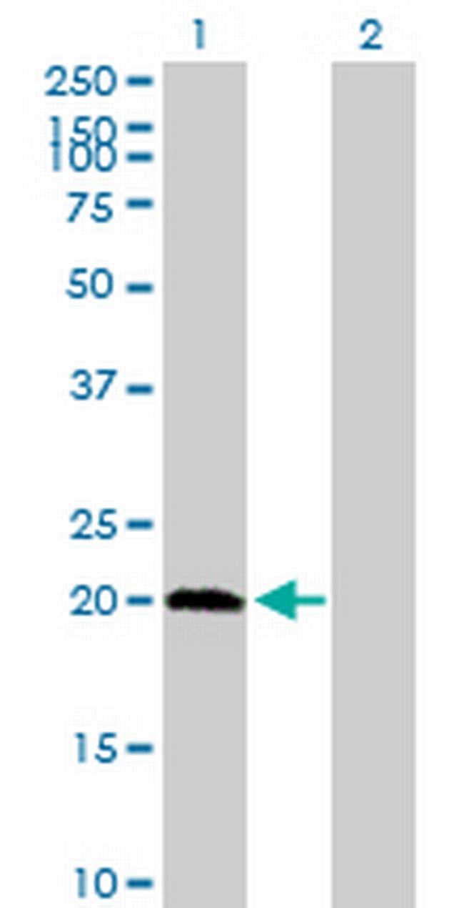 PPCDC Antibody in Western Blot (WB)