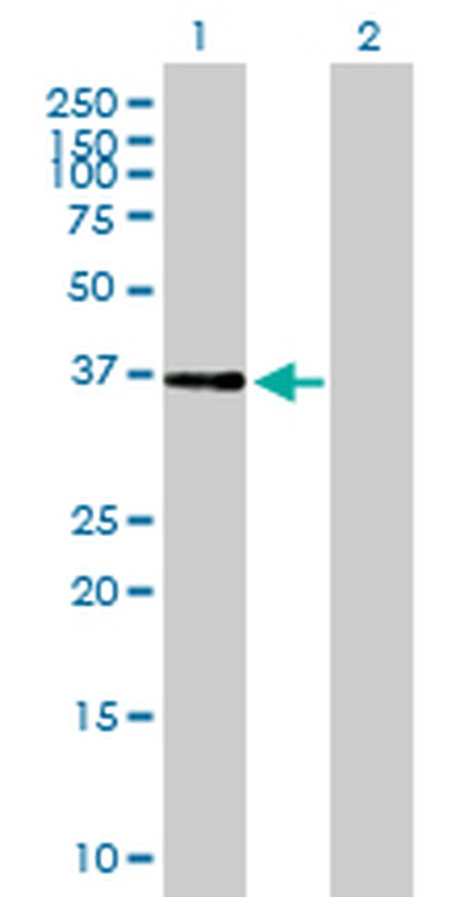 NIF3L1 Antibody in Western Blot (WB)