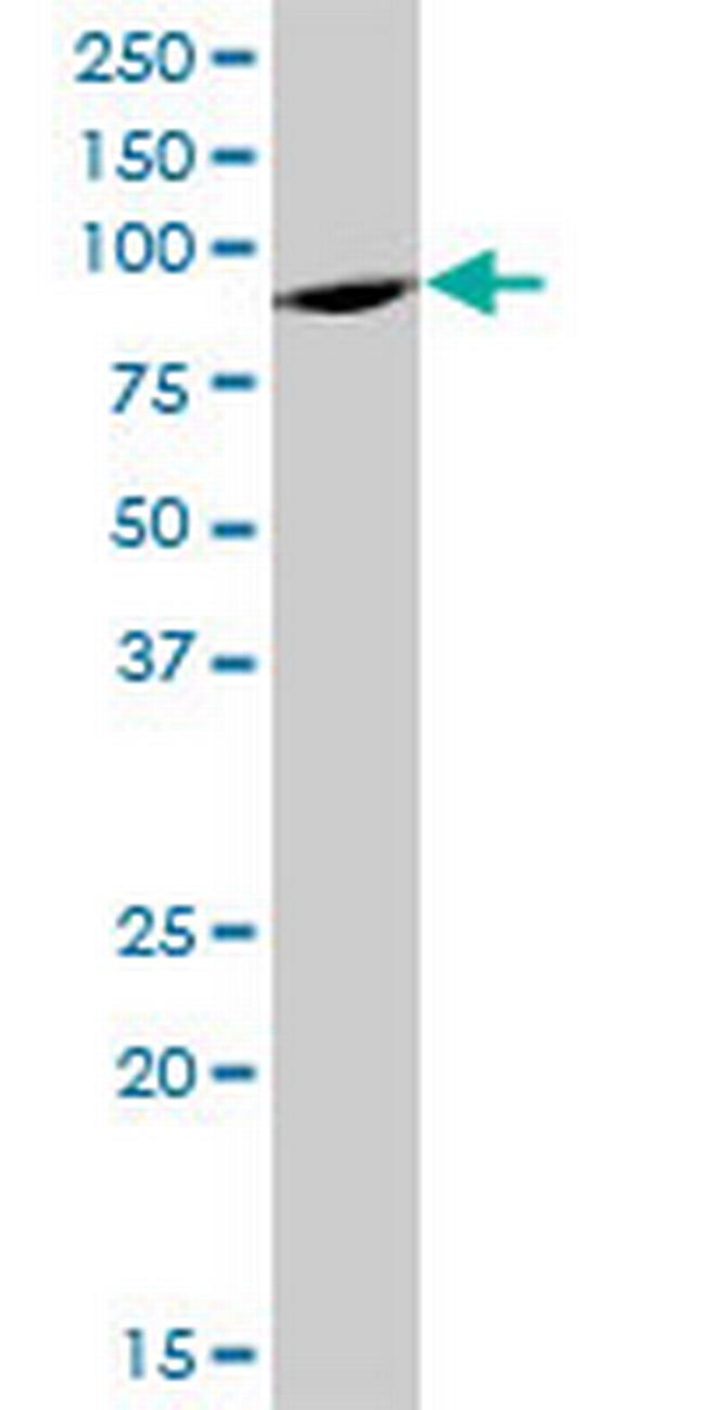 ELAC2 Antibody in Western Blot (WB)