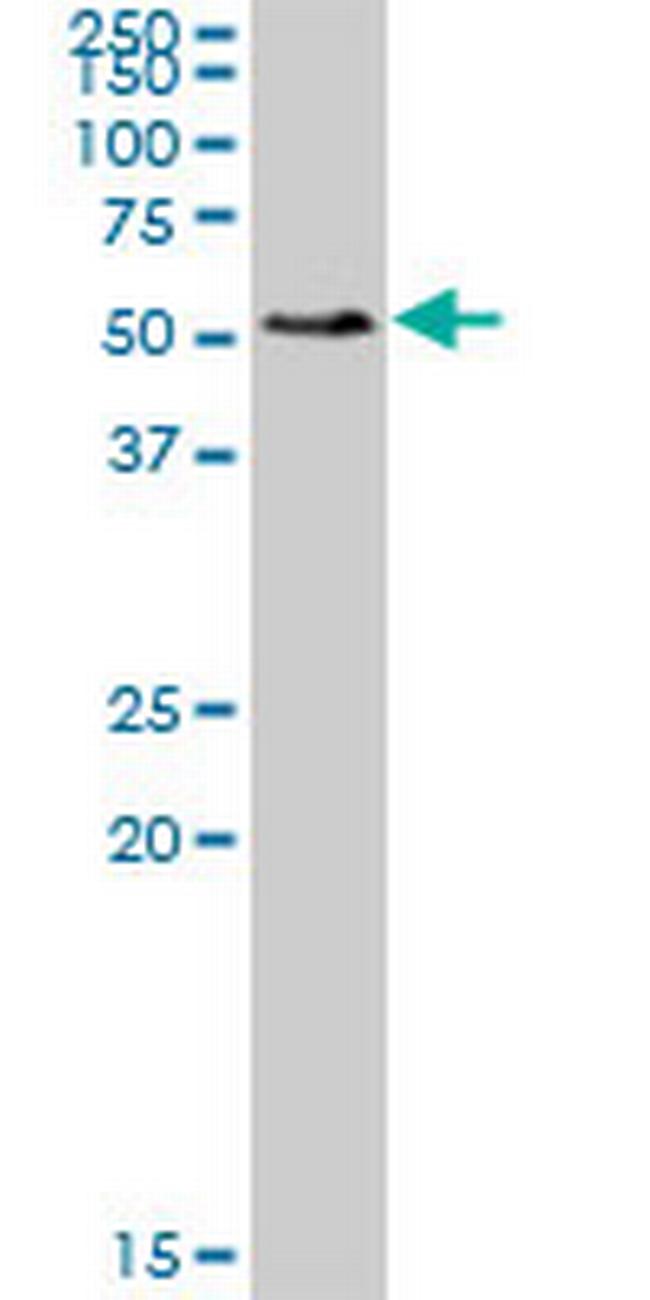 SMAP1 Antibody in Western Blot (WB)