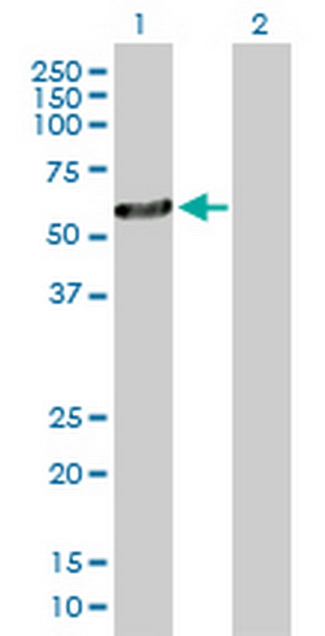 OXCT2 Antibody in Western Blot (WB)