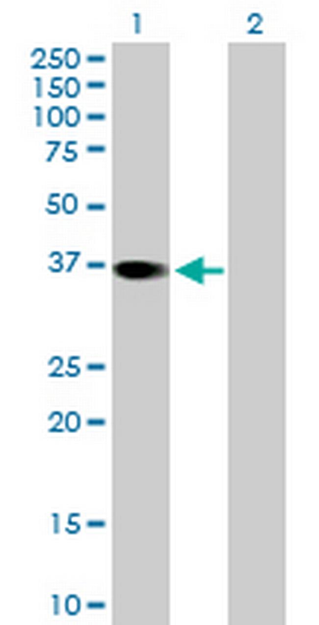 RBKS Antibody in Western Blot (WB)