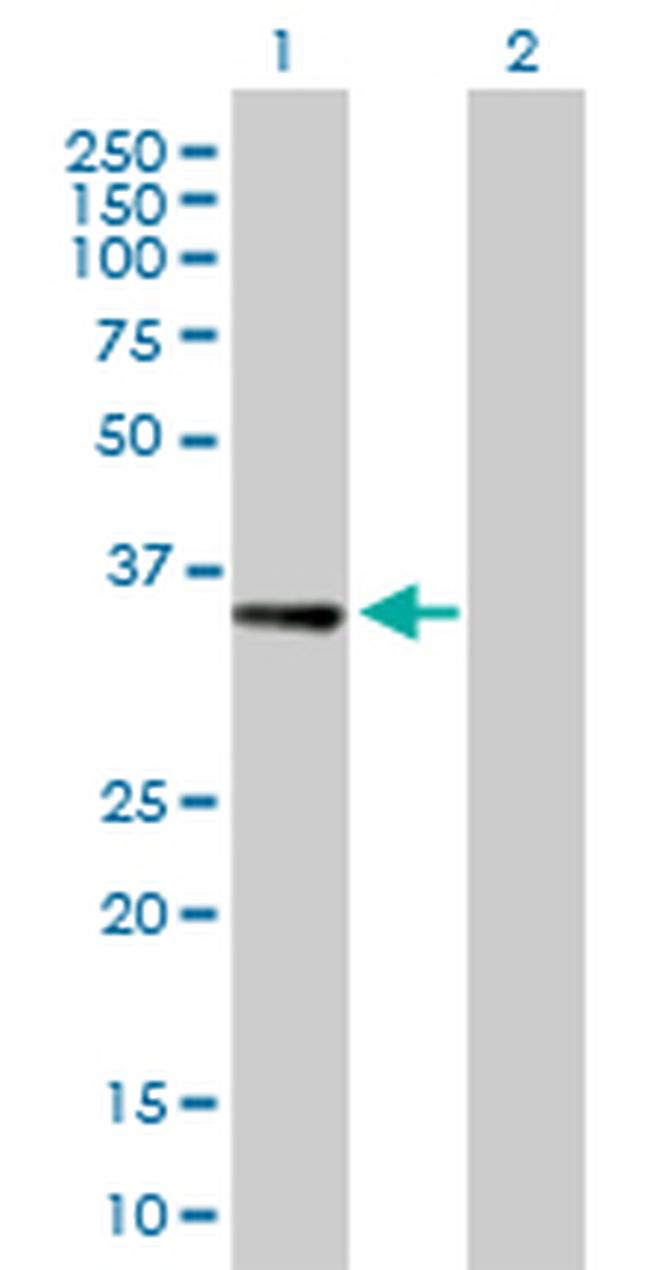 RBKS Antibody in Western Blot (WB)