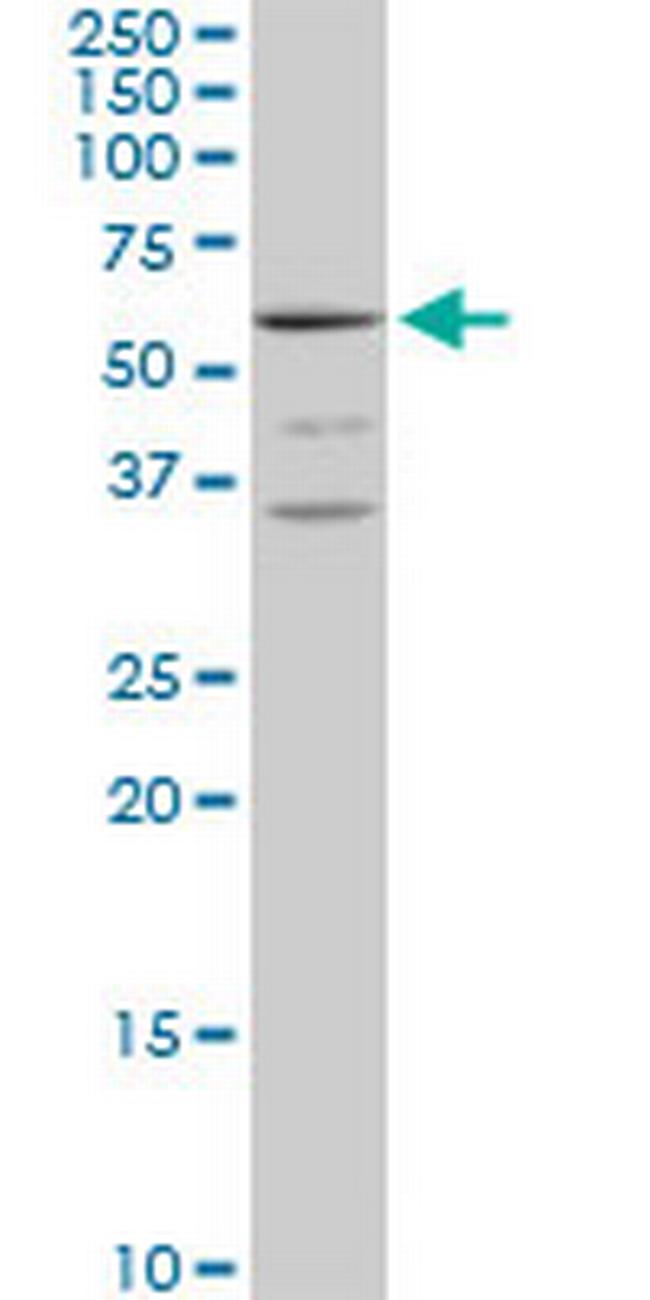 MCCC2 Antibody in Western Blot (WB)