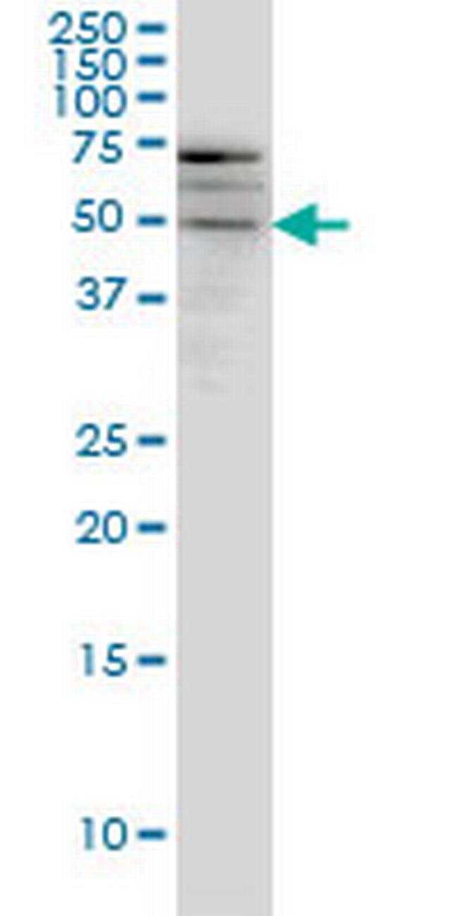 SMOC1 Antibody in Western Blot (WB)