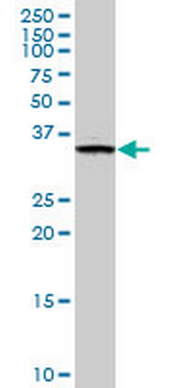 FN3K Antibody in Western Blot (WB)