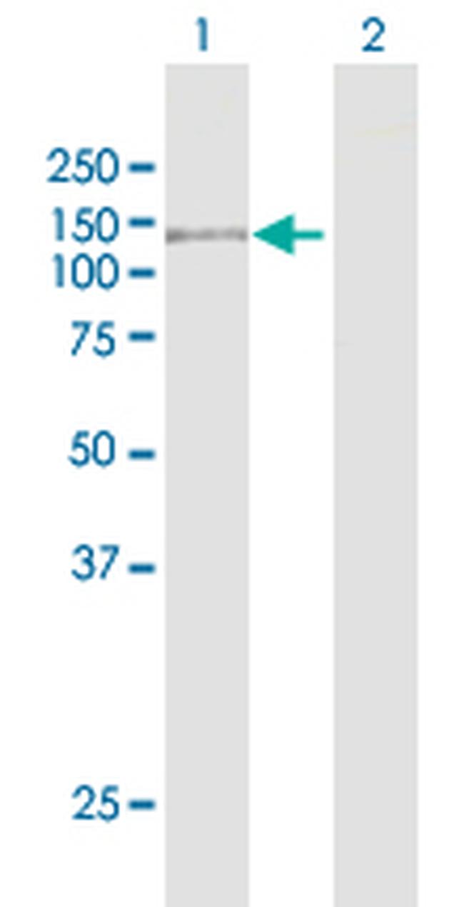 NOD2 Antibody in Western Blot (WB)