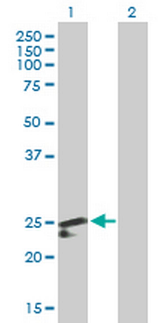 PDF Antibody in Western Blot (WB)