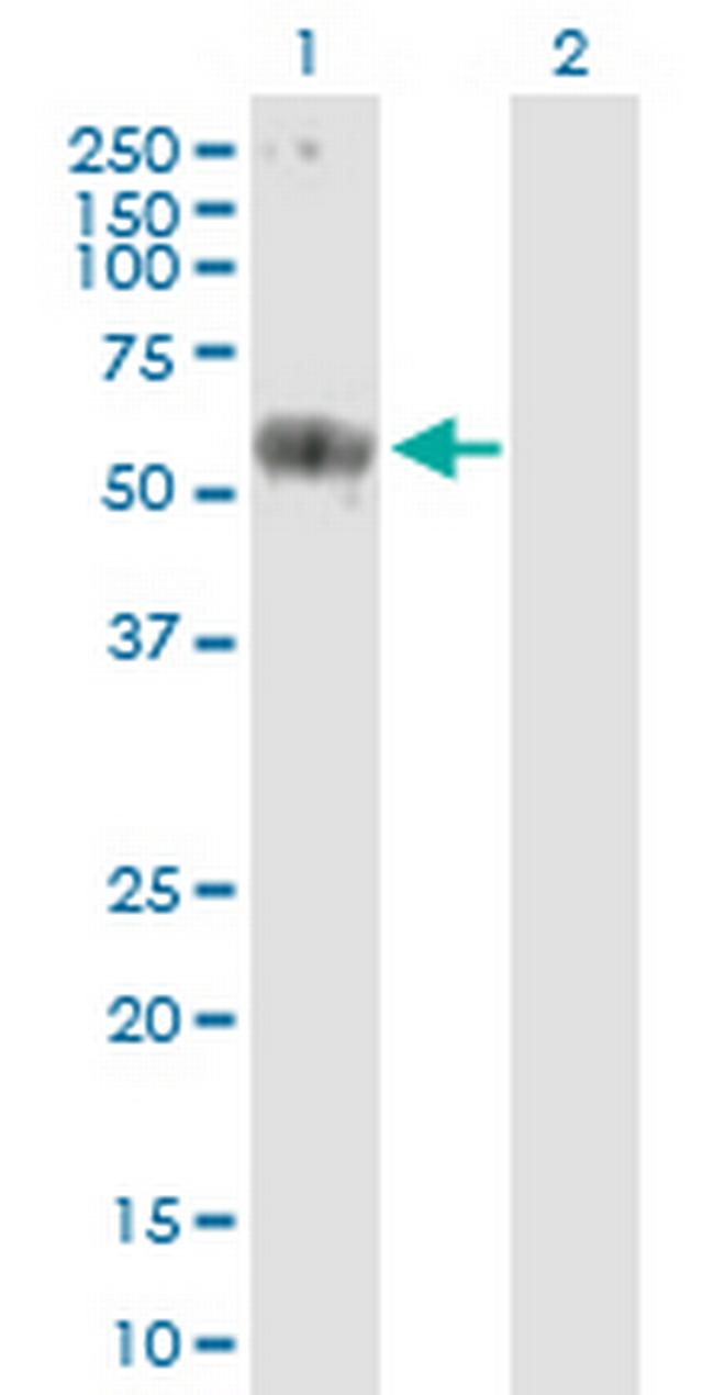 CARD9 Antibody in Western Blot (WB)