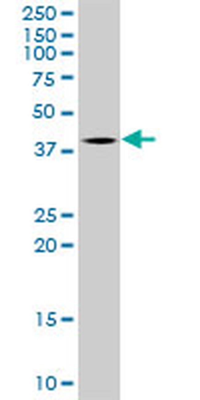 TFB2M Antibody in Western Blot (WB)