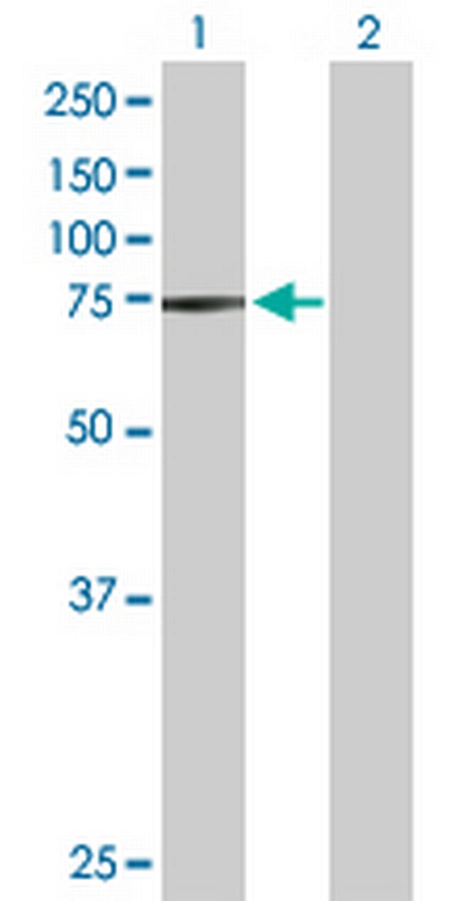 STRA6 Antibody in Western Blot (WB)