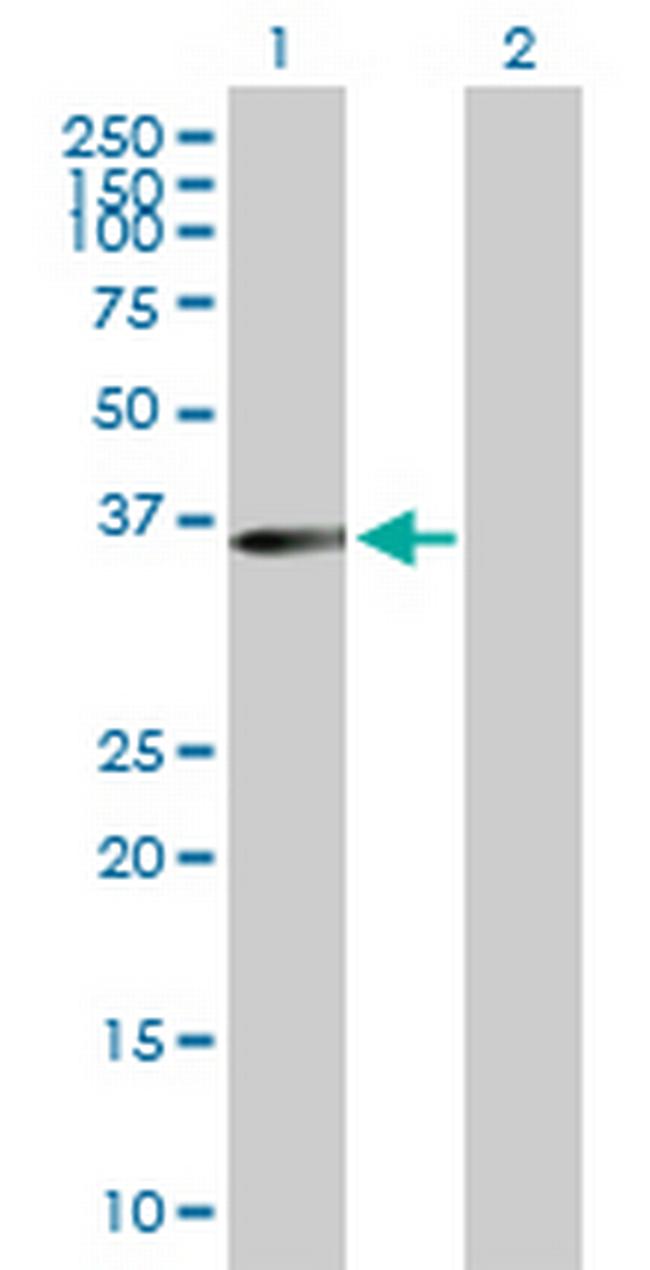 MLST8 Antibody in Western Blot (WB)