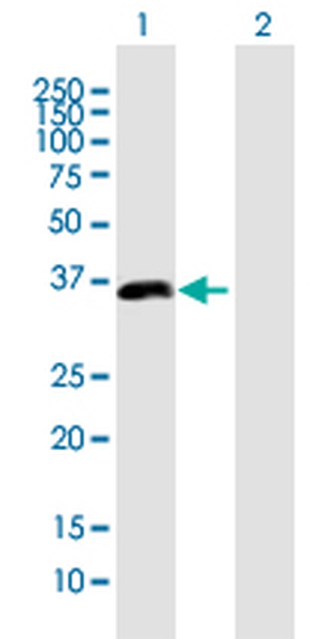 PDLIM2 Antibody in Western Blot (WB)