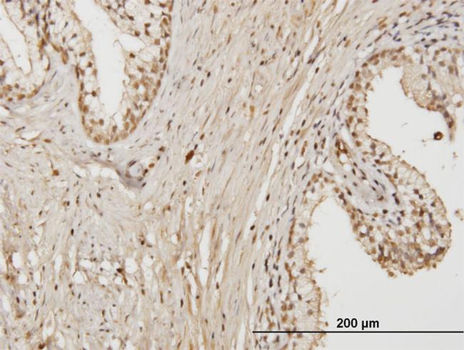 RAB17 Antibody in Immunohistochemistry (Paraffin) (IHC (P))