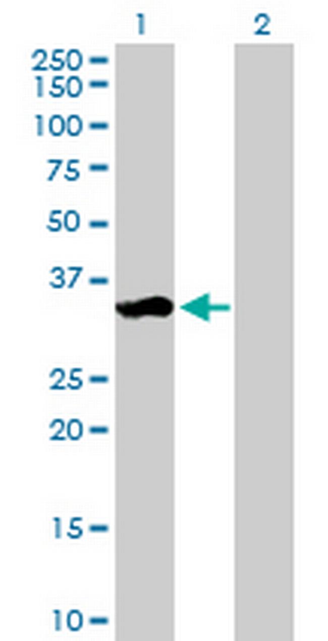 WIG1 Antibody in Western Blot (WB)