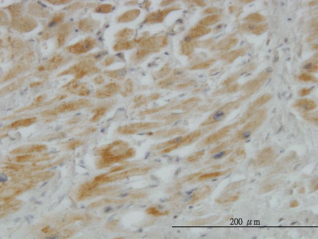 HHIP Antibody in Immunohistochemistry (Paraffin) (IHC (P))