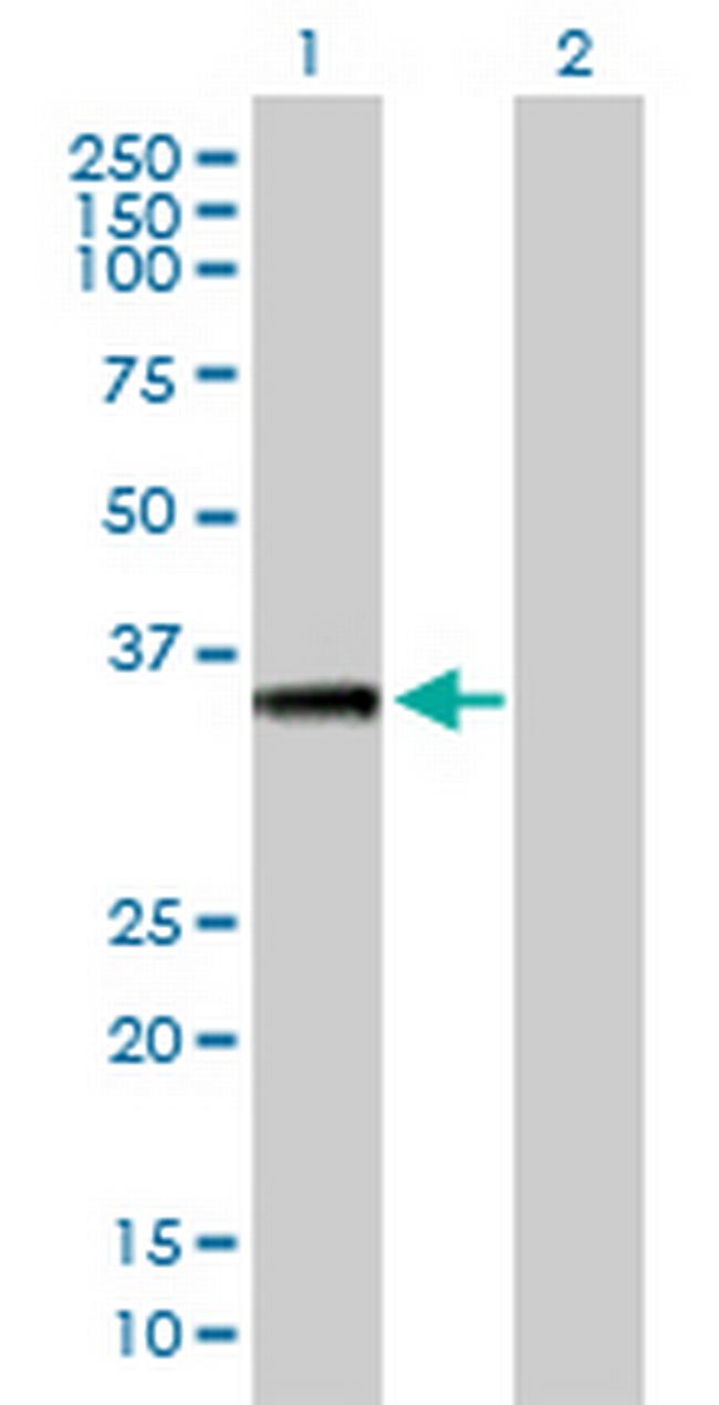 AKTIP Antibody in Western Blot (WB)