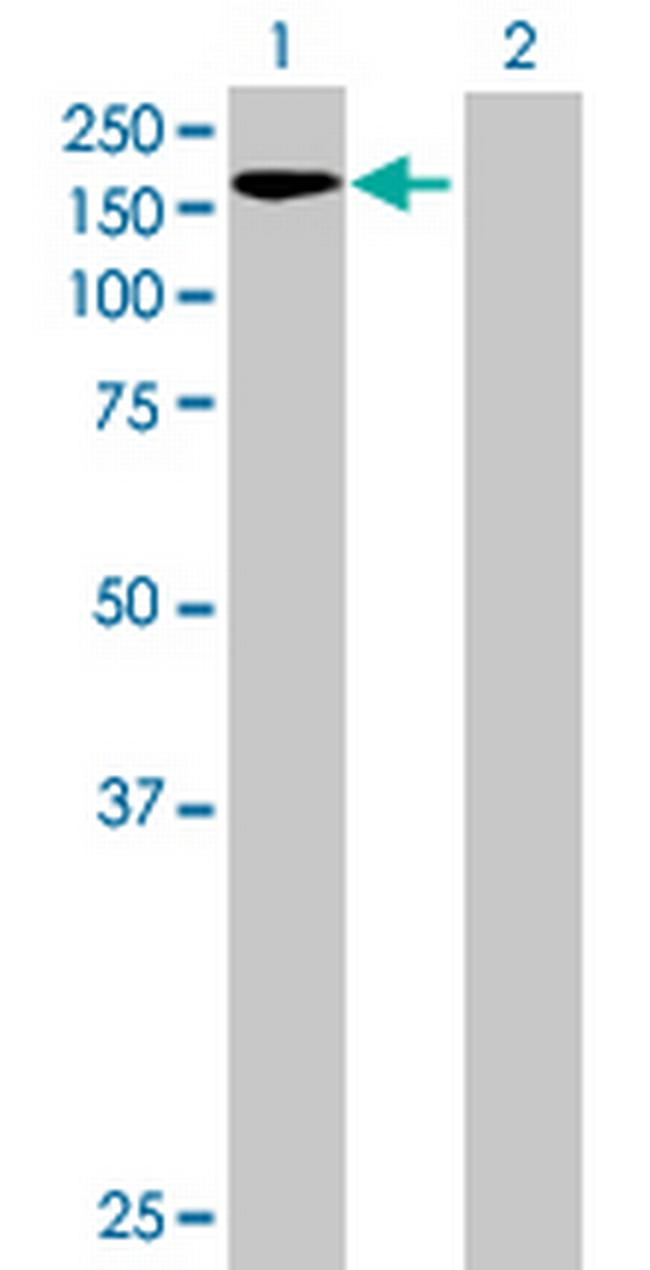 ZNF574 Antibody in Western Blot (WB)