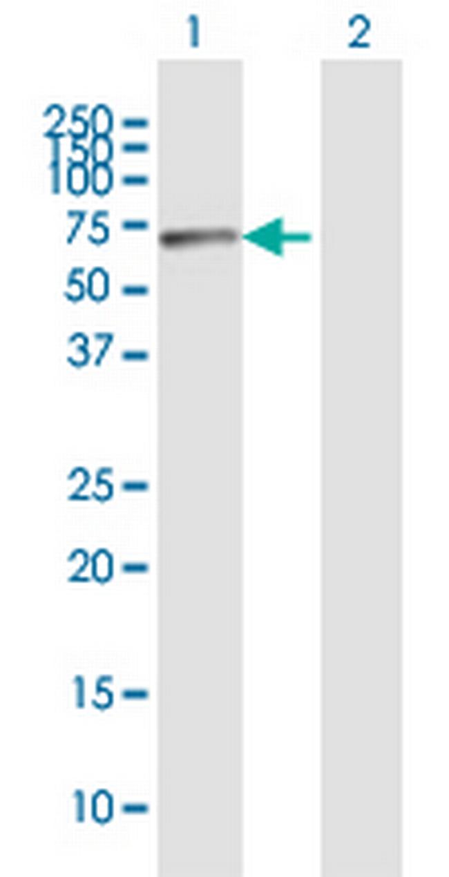 RBM15 Antibody in Western Blot (WB)