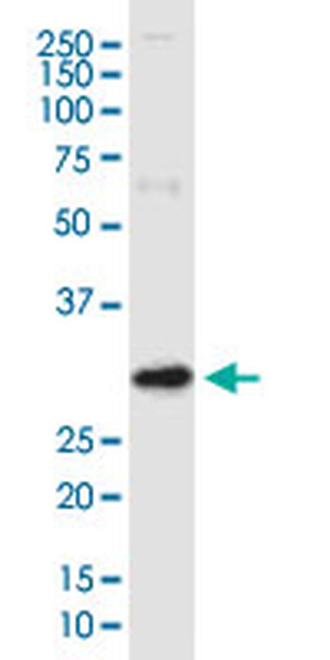 ARV1 Antibody in Western Blot (WB)