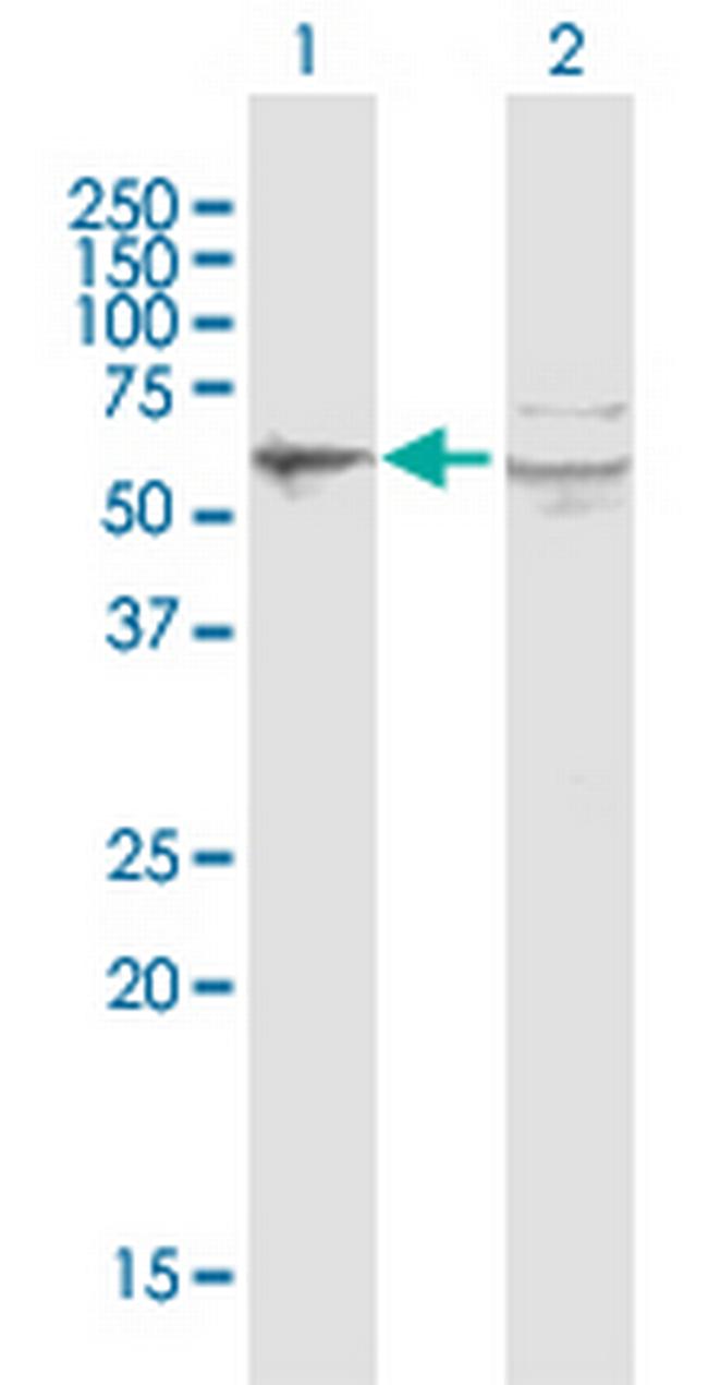 PORCN Antibody in Western Blot (WB)