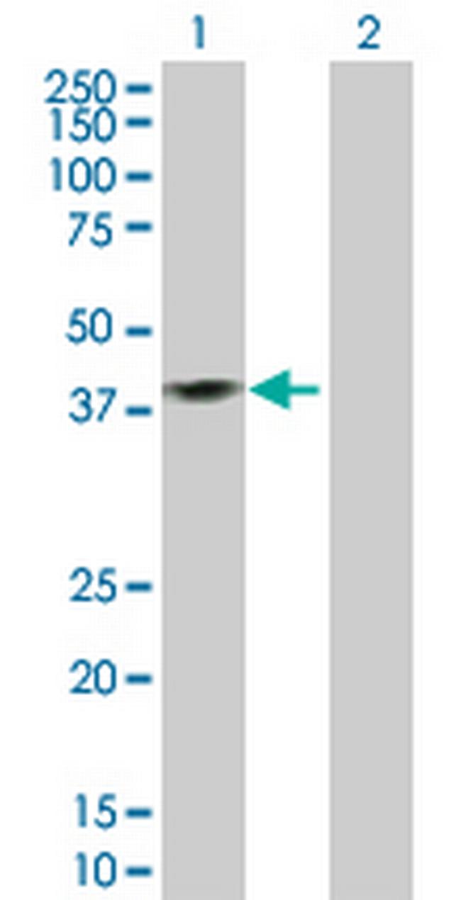 ISL2 Antibody in Western Blot (WB)