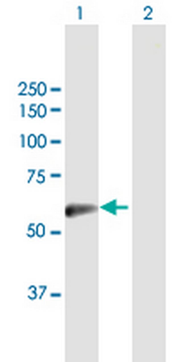 SLC13A3 Antibody in Western Blot (WB)