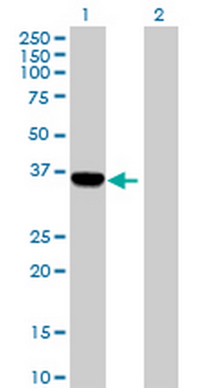 C1orf80 Antibody in Western Blot (WB)