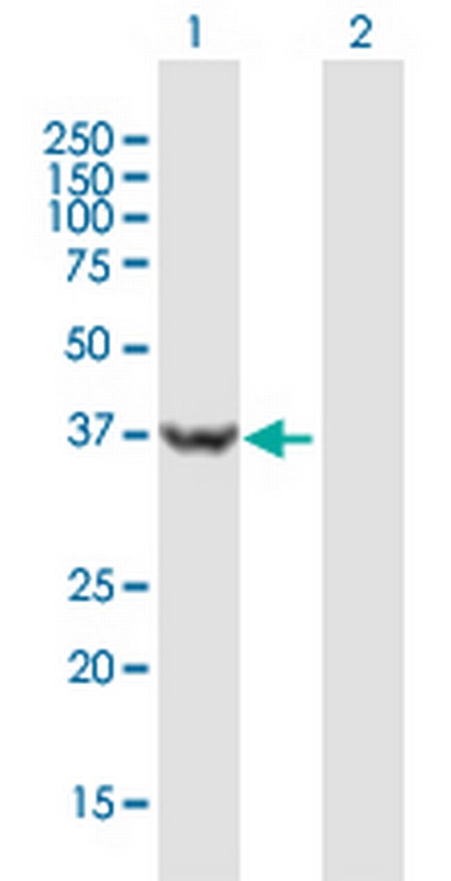 USP46 Antibody in Western Blot (WB)